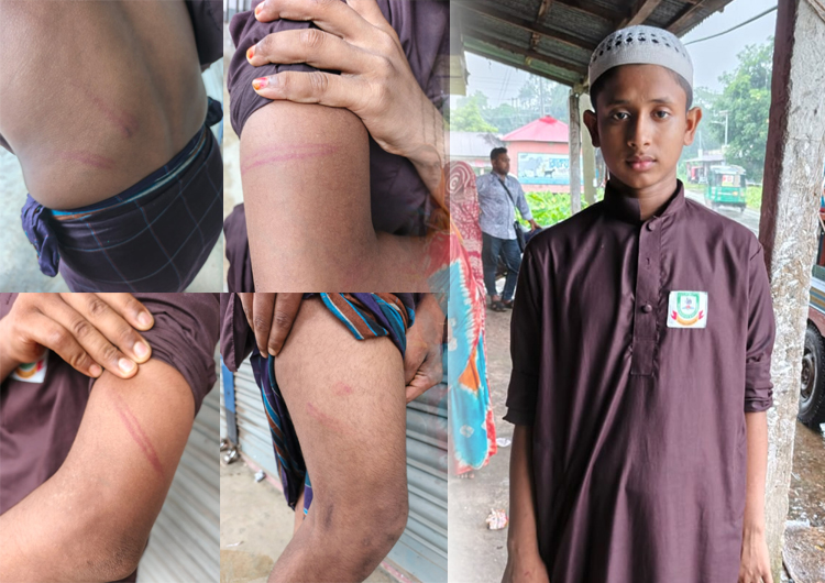 রাজনগরে মাদ্রাসা ছাত্রকে বেদম প্রহার : থানায় অভিযোগ