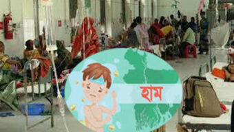 সিলেটে হাম উপসর্গে আরেক শিশুর মৃত্যু