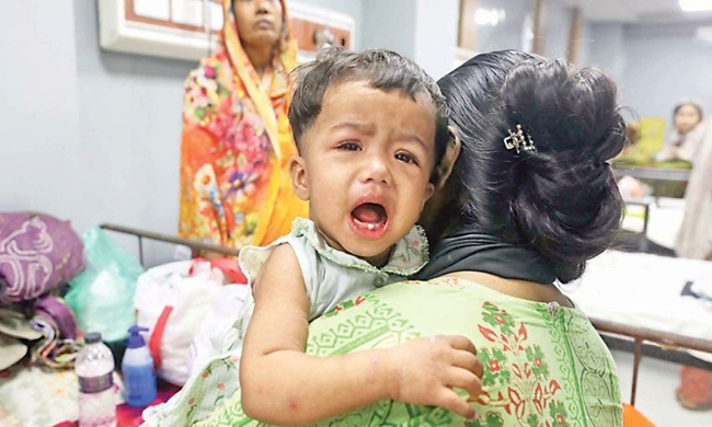 হামের উপসর্গে আরও ৫ মৃত্যু, আক্রান্ত ৯৮৬ জন